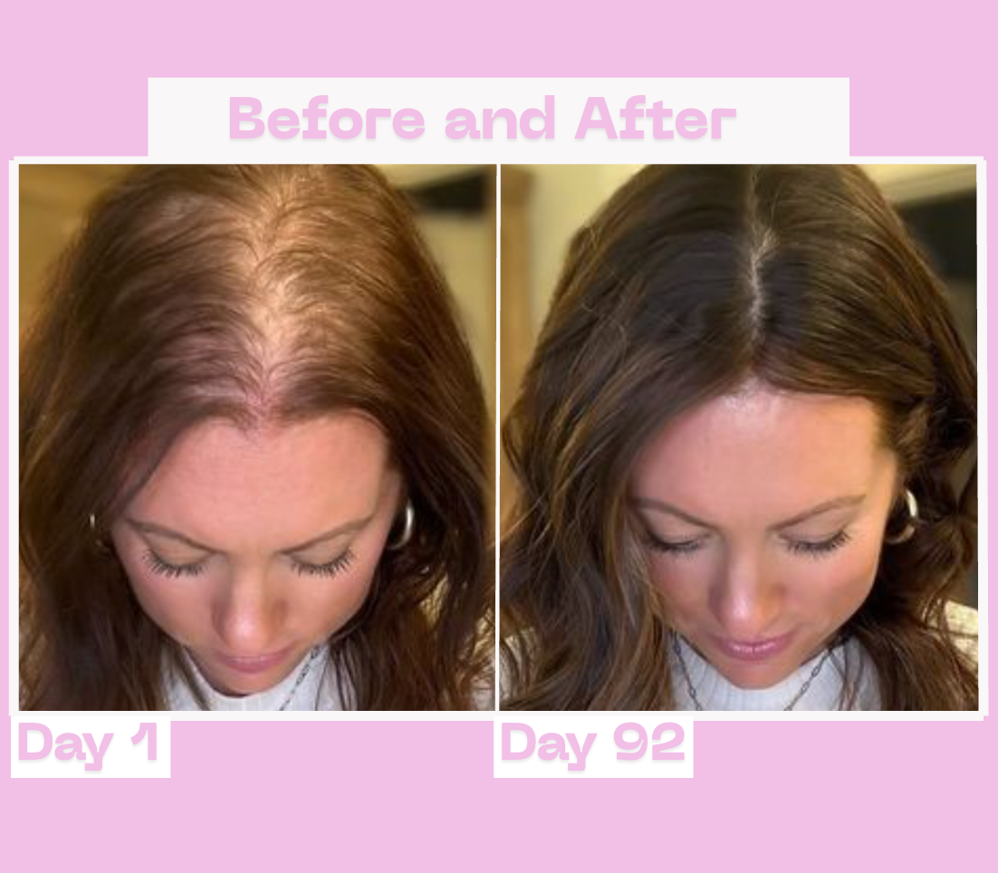 SilverPeek Hair Accelerator Chews