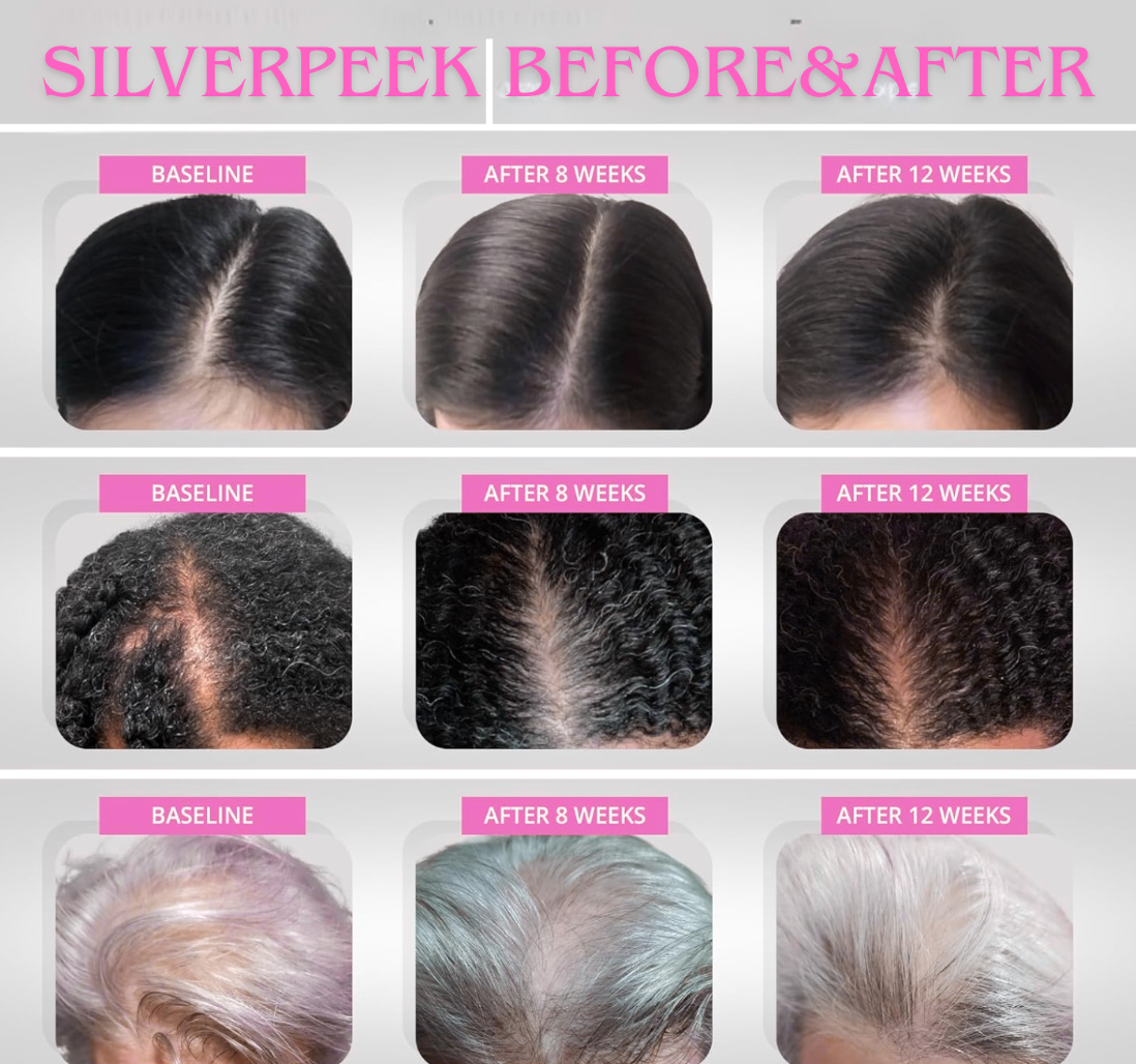 SilverPeek Hair Accelerator Chews